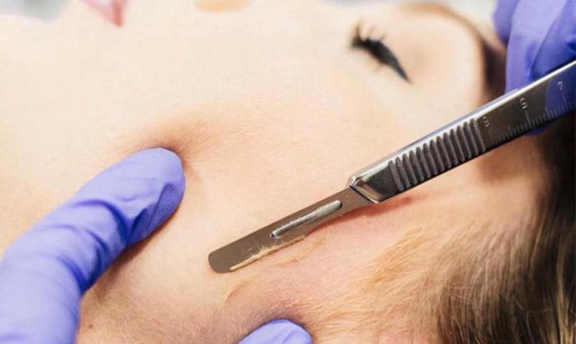 Dermaplaning > Perfect Touch MedSpa