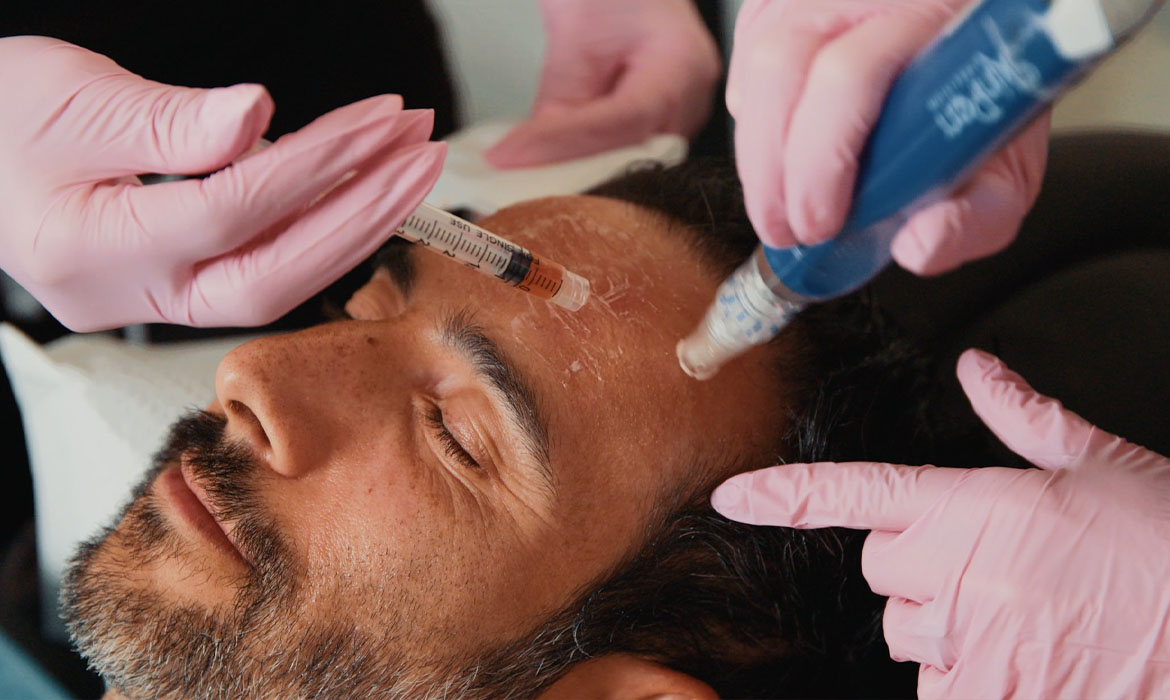 Microneedling with PRF (Filler) > Perfect Touch MedSpa