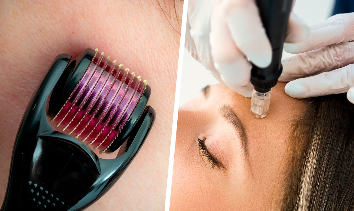 Microneedling > Perfect Touch MedSpa