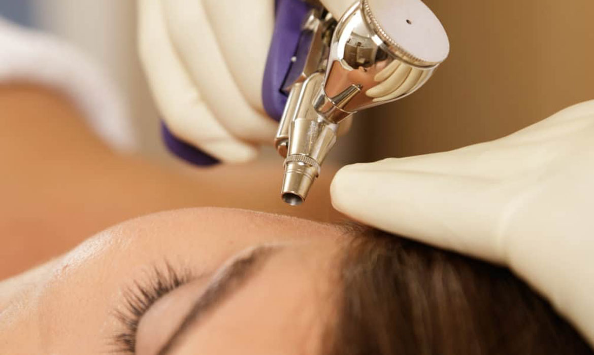 Oxygen Facial